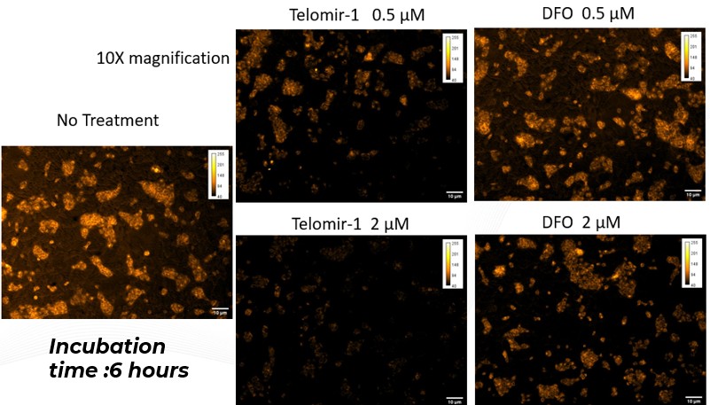 Telomir Pharmaceuticals Reports Telomir-1 Outperforms FDA-Approved Gold-Standard Iron Chelator Deferoxamine (DFO) in Reducing Intracellular Iron in a Human Cell Line