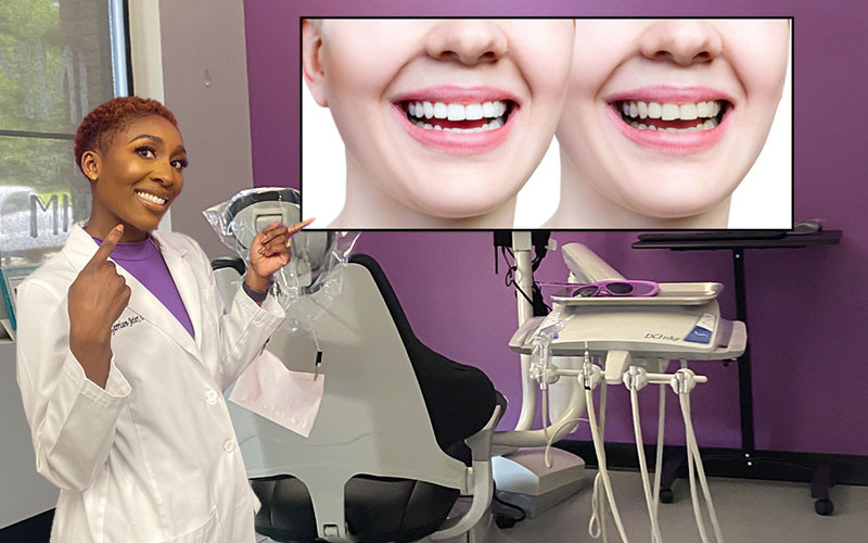 Dental Expert Warns Against DIY Chipped Tooth Repairs in New Article